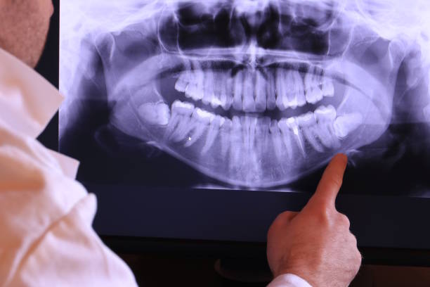 Best After-Hours Emergency Dentist in San Anselmo, CA