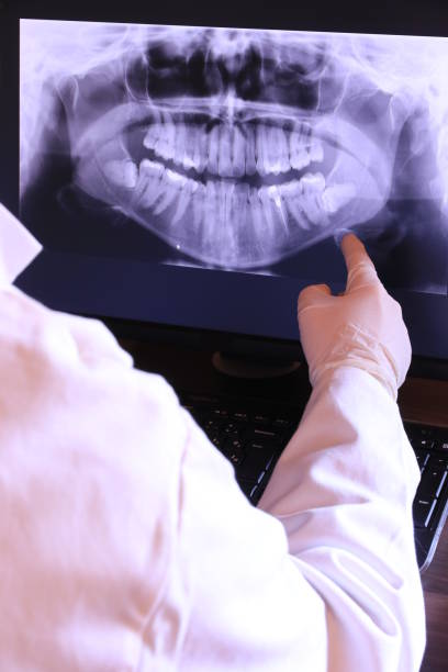 Best Emergency Tooth Extraction in San Anselmo, CA