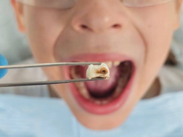 Best Pediatric Emergency Dentist in San Anselmo, CA